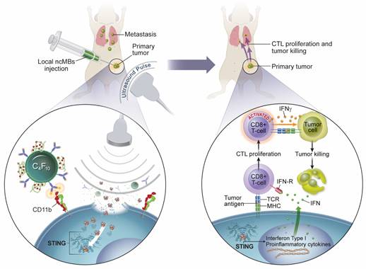 A microbubble-assisted ultrasound-guided immunotherapy