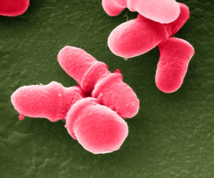 Evidence is mounting that microorganisms in the human gut can impact a person's neurological and emotional health. Credit: J.H. Carr, CDC, via NIH.