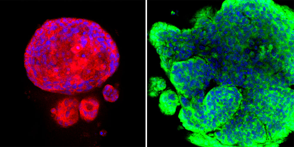 Organoids