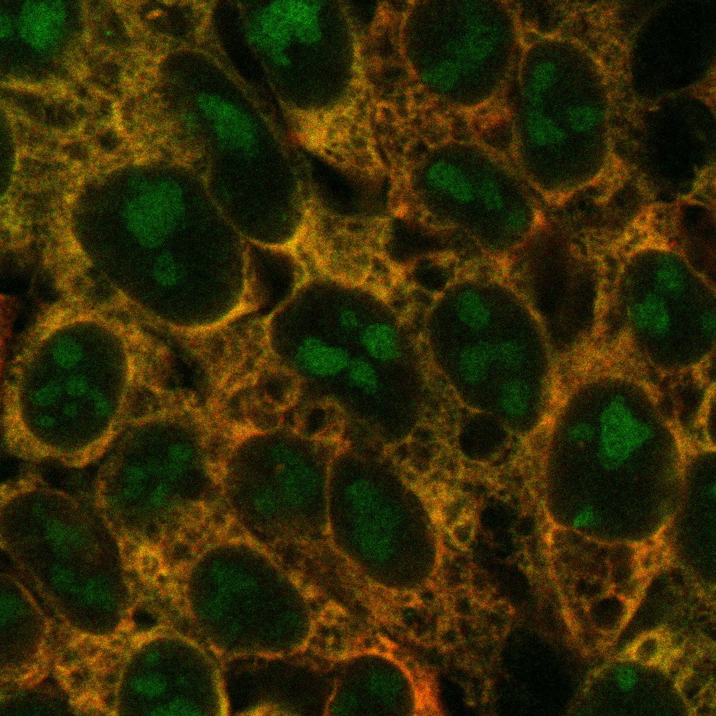 Human cells with old ribosomes