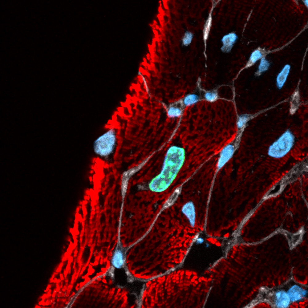 Heart muscle cells