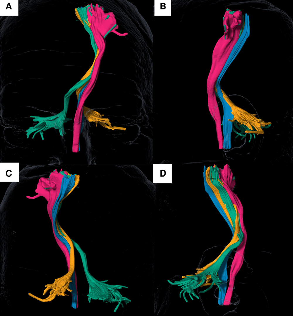 Four-tract tractography