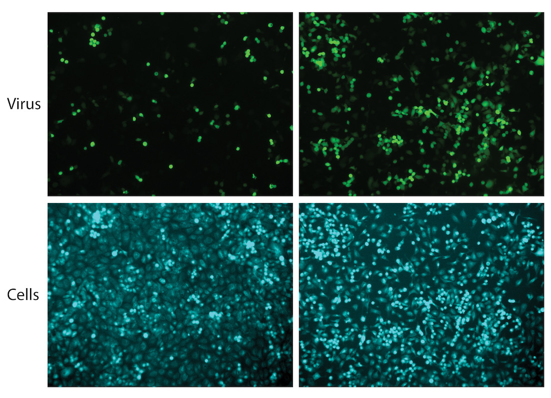 human cancer cells expressing the bacterial effector protein IpaH4