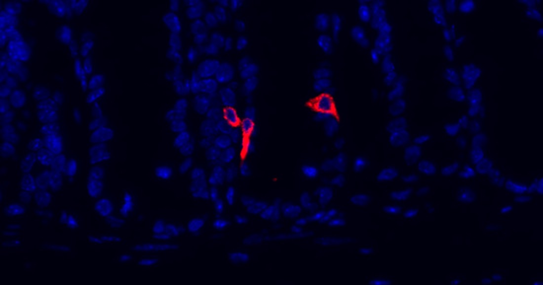 Enteroendocrine cells