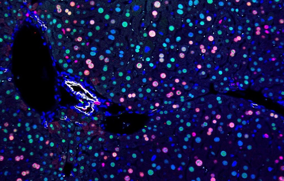 Fluorescents on a regenerative liver.