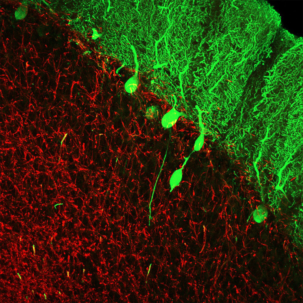 Purkinje cells image