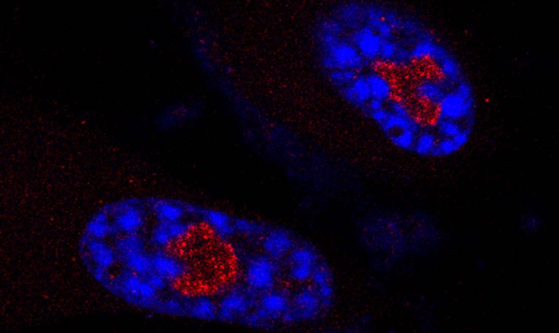 SNORA13 (red) in the nucleus of senescent human cells