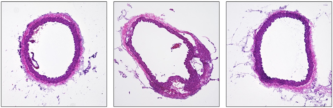 Base editing image