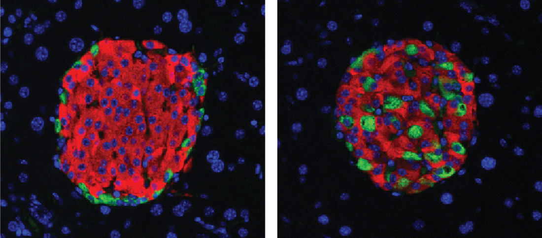 Cluster of pancreatic cells