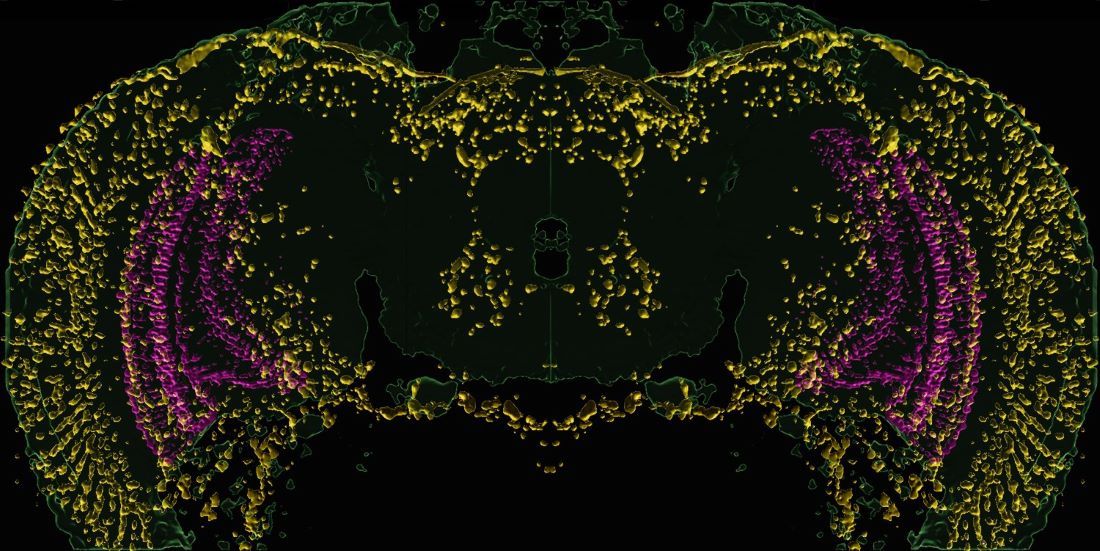 A fluorescent image shows stress-related proteins (yellow) accumulating in the brain of a visually impaired fruit fly.