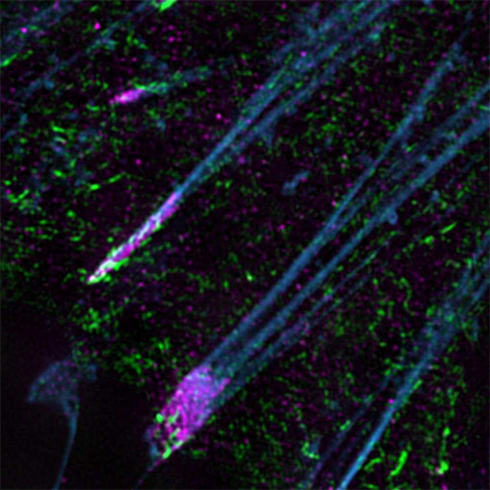 fluorescent microscopy image