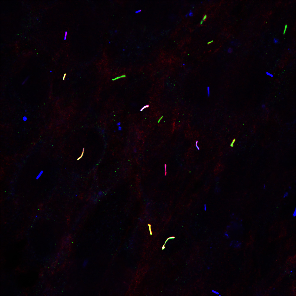 Fluorescent microscopy image