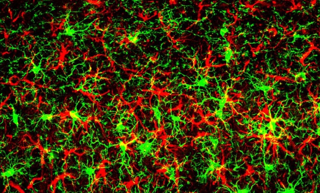 Fluorescent image