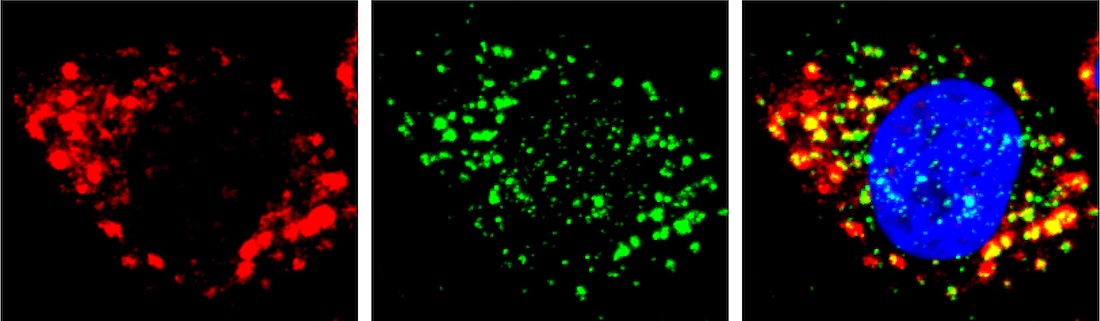 Stress granules (red) form
