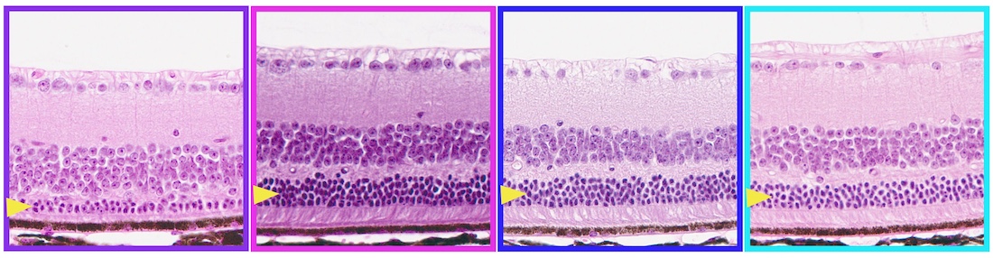Microscopic images of retinal sections show photoreceptors, the cells that sense light for vision, marked by a yellow arrow. 