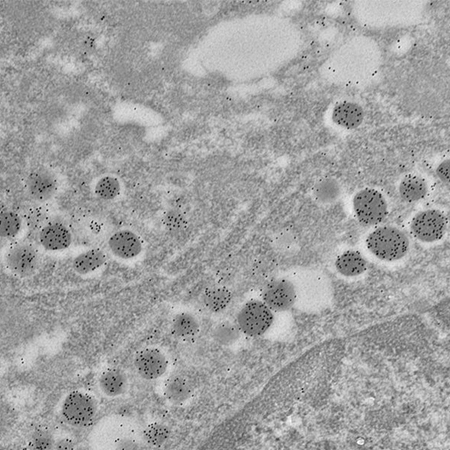 TEM with immunolabeling TEM with immunolabeling