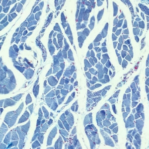 Heart Muscle